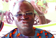 District sanitaire de Kaya: Réduire la prévalence de la cécité