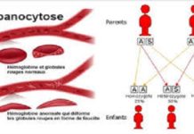 Drépanocytose: National Institutes of Health prévoit d’investir au moins 100 millions de dollars