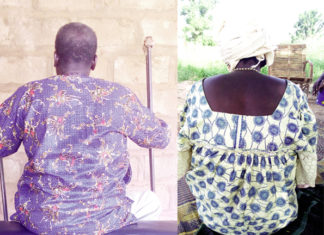 Handicap et VIH : «Personne ne veut s’approcher de moi»