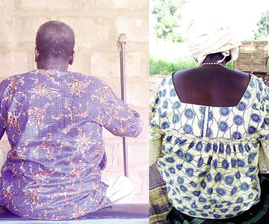 Handicap et VIH : «Personne ne veut s’approcher de moi»