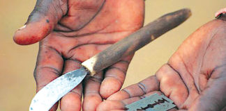 Boucle du Mouhoun: Quand des exciseuses abandonnent lames et couteaux