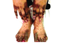 Pr Augustin Palé, anthropologue : «La dépigmentation s’inscrit dans une problématique complexe »