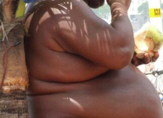 Monde : Plus de la moitié de l’humanité sera obèse d’ici 2035