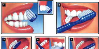 Santé bucco-dentaire : une bonne hygiène permet d’éviter les maladies