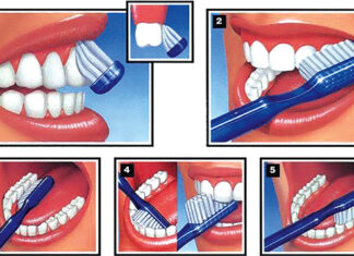 Santé bucco-dentaire : une bonne hygiène permet d’éviter les maladies