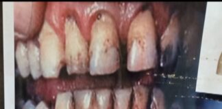 Santé publique : Les dangers du tabagisme passif