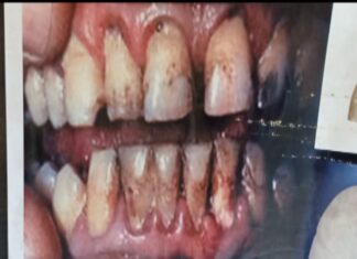 Santé publique : Les dangers du tabagisme passif