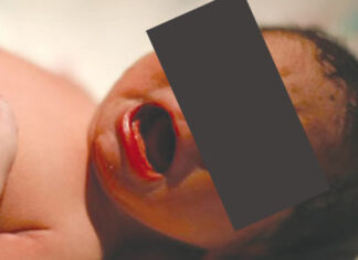 Coliques chez le nourrisson : surveiller l’alimentation de la mère