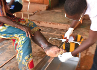 Insertion des malades guéris de la lèpre : ces centres d’accueil qui prolongent la vie des patients