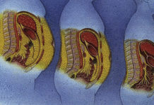 Graisse abdominale: le choix d’une alimentation équilibrée est essentiel
