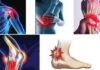 Tendinites tendinopathies : consultez vite un médecin