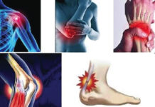 Tendinites tendinopathies : consultez vite un médecin