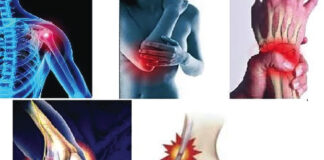 Tendinites tendinopathies : consultez vite un médecin