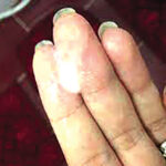 Pertes blanches : l’aspect, la couleur et l’odeur, des révélateurs d’un problème de santé