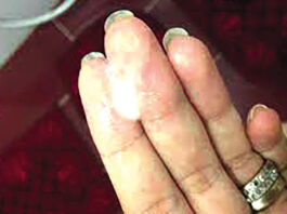 Pertes blanches : l’aspect, la couleur et l’odeur, des révélateurs d’un problème de santé