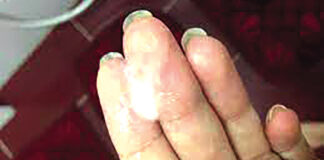 Pertes blanches : l’aspect, la couleur et l’odeur, des révélateurs d’un problème de santé