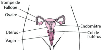 Douleurs pelviennes chez la femme : consulter immédiatement un médecin en cas de signes avant-coureurs