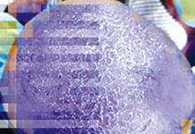 Croutes de lait : instaurer les soins de toilette avec un shampooing doux