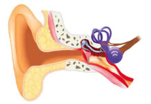 L’otite: Une infection courante à ne pas sous-estimer