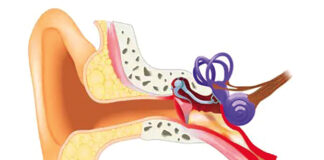 L’otite: Une infection courante à ne pas sous-estimer