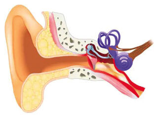 L’otite: Une infection courante à ne pas sous-estimer