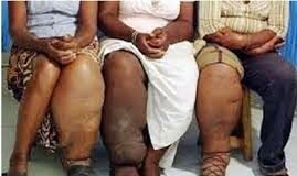 Lutte contre les MTN : la campagne « Aller plus loin » de Speak Up Africa fait entendre de nouvelles voix