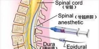 Sciences de la santé Les choses de l’anesthésie chirurgicale que vous devez savoir