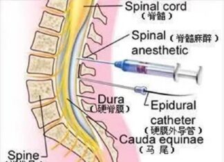 Sciences de la santé Les choses de l’anesthésie chirurgicale que vous devez savoir