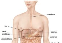 La maladie de Crohn : les complications nécessitent une prise en charge médicale urgente