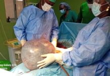 Kystes ovariens: Consulter un médecin si des symptômes apparaissent