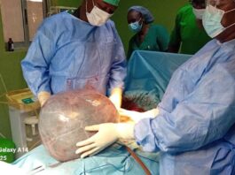 Kystes ovariens: Consulter un médecin si des symptômes apparaissent