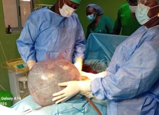 Kystes ovariens: Consulter un médecin si des symptômes apparaissent